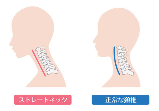 デスクワークの方にとっても多いお身体のつらさ